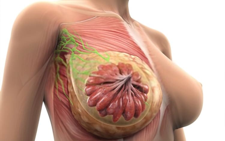 Ganglio centinela en cáncer de mama